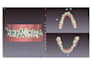 do clear aligner treatment planning as an orthodontist